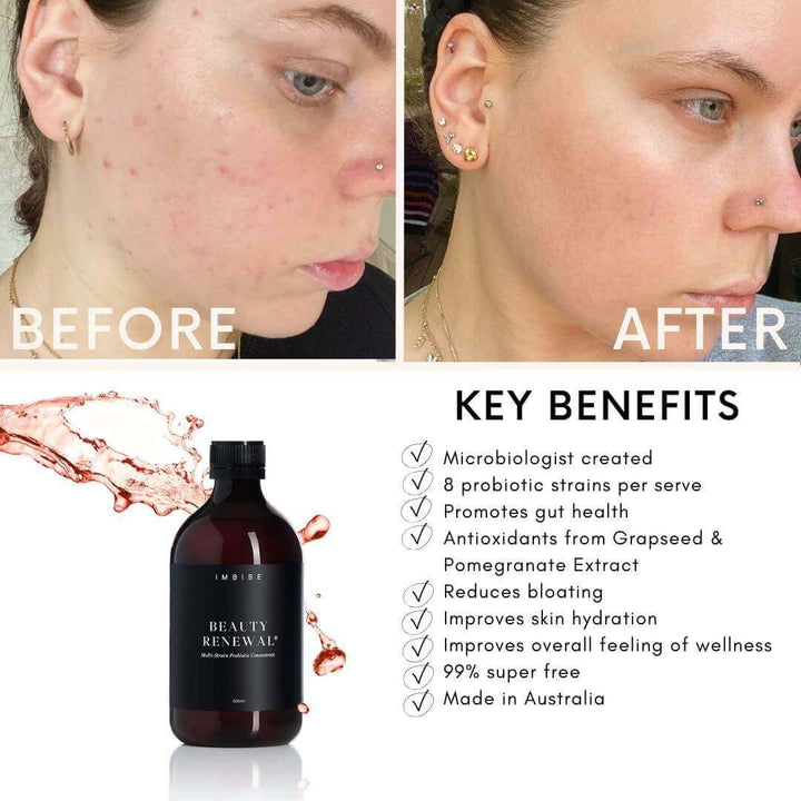beauty renewal imbibe gut health probiotic