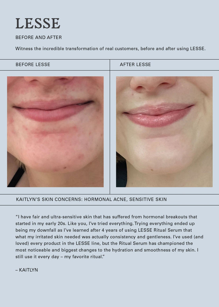 Lesse Skin care ritual serum natural skincare for acne sensitive skin