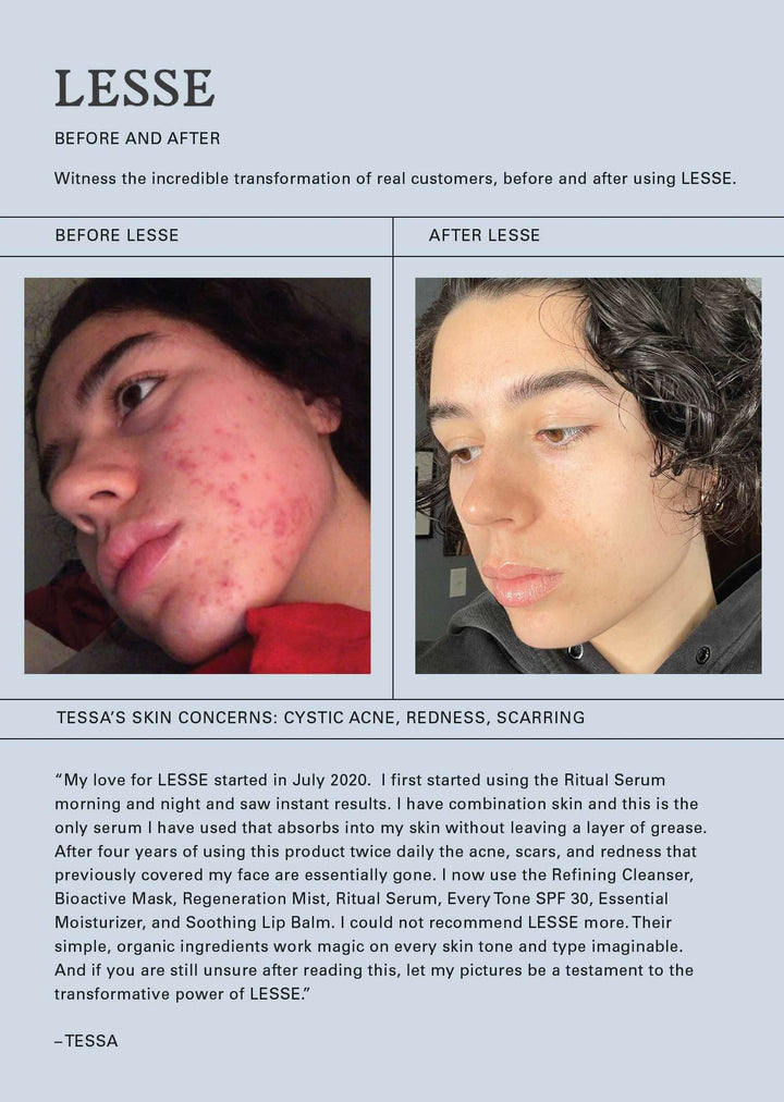 Natural skincare results micro exfoliator cleanser Lesse skin care