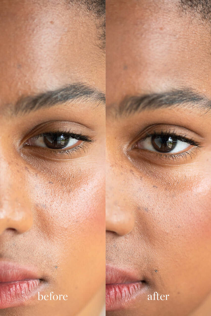 ere perez corn setting powder before and after