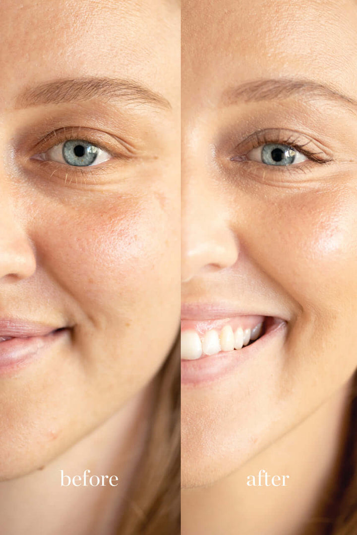 Beauty corrector