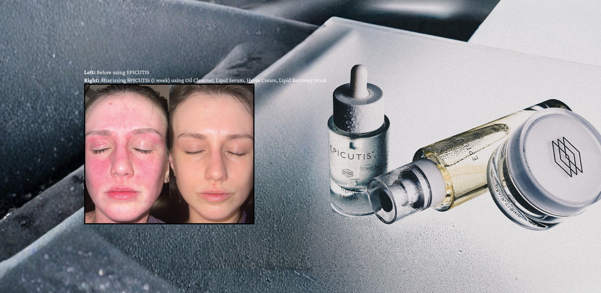 Best sensitive skincare for before and after reviews