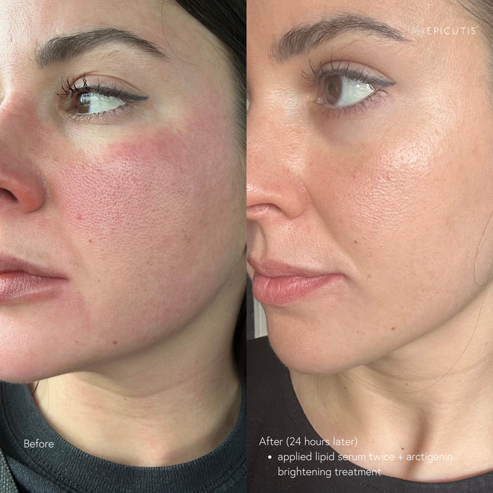 before and after to calm and smooth skin