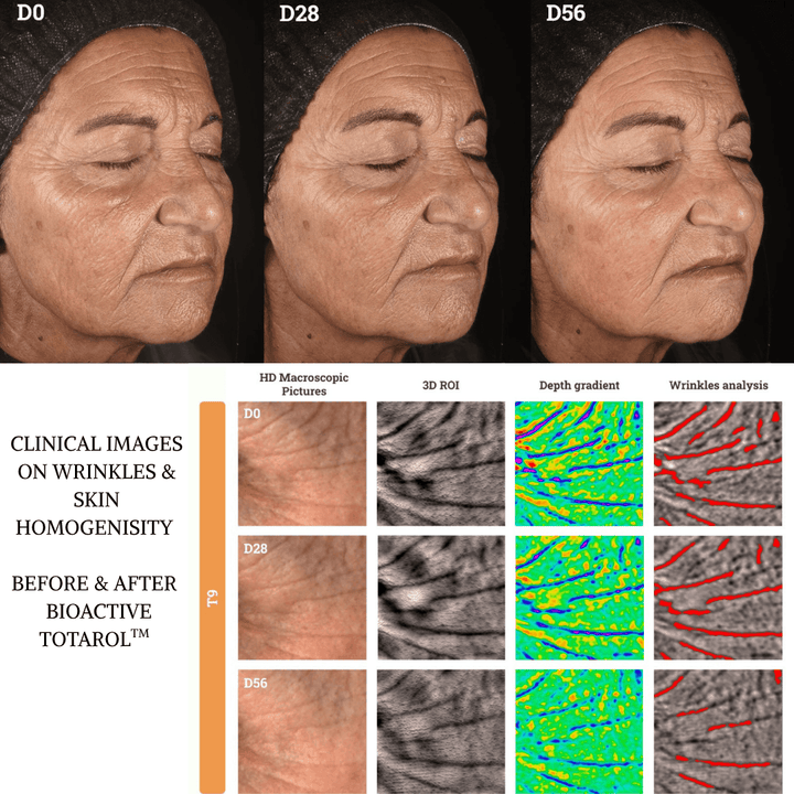 bioactive totarol clinical results wrinkles
