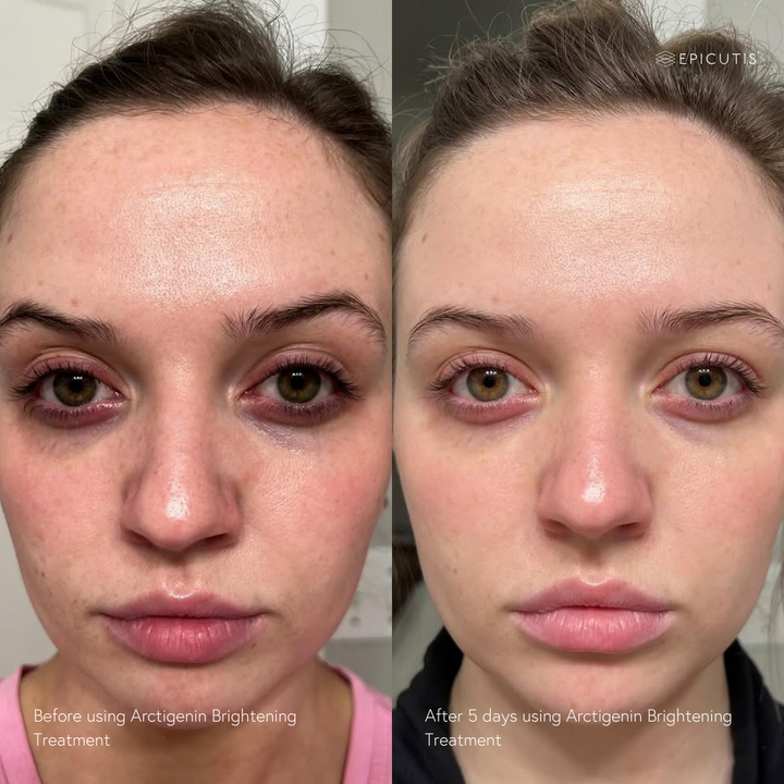 brightening treatment for redness 