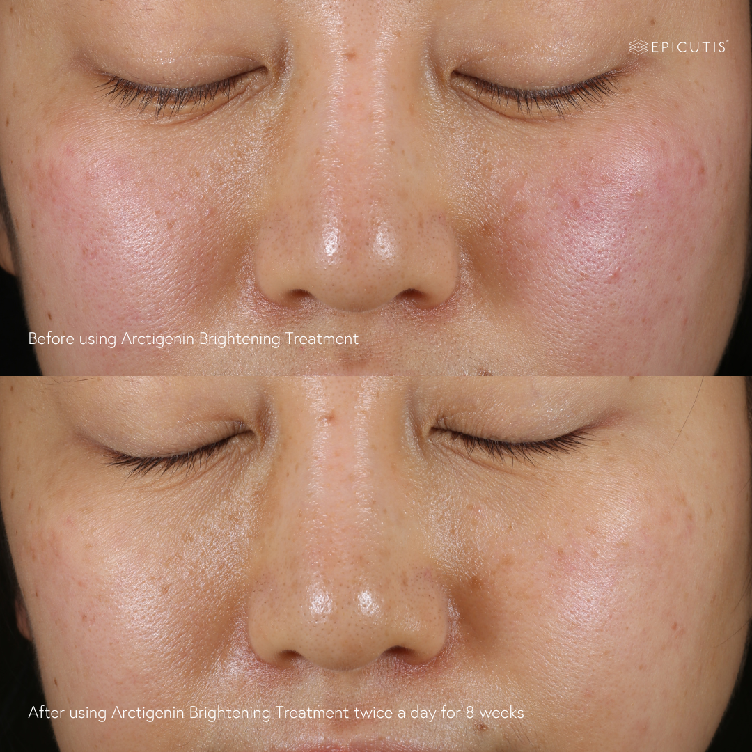 brightening serum testing pigmentation