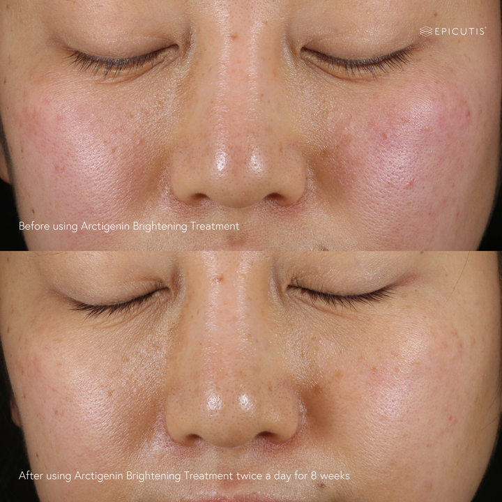 brightening serum testing pigmentation