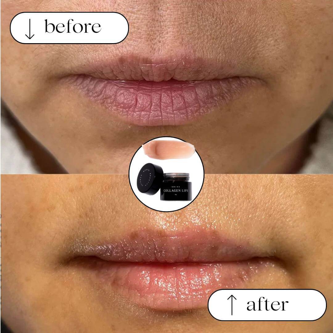 Collagen Lips natural lip lift