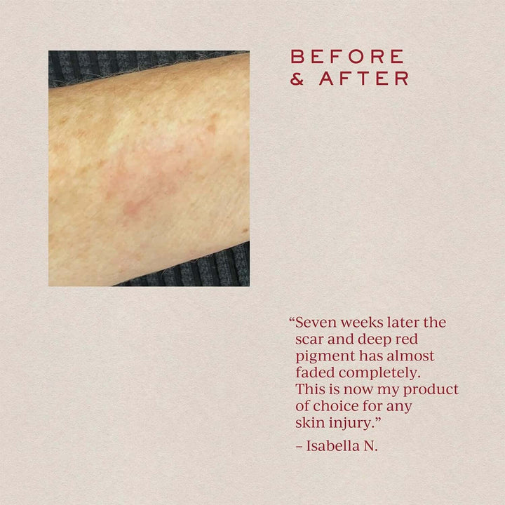 Tronque customer reviews on scare treatment oil