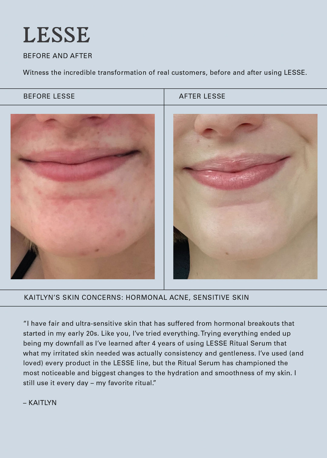 Jesse ritual serum natural skincare for acne sensitive skin