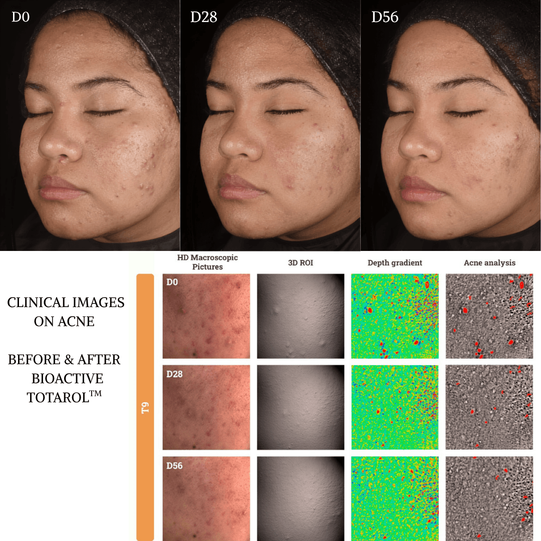 skincare clinical study bioactive totarol TWYG