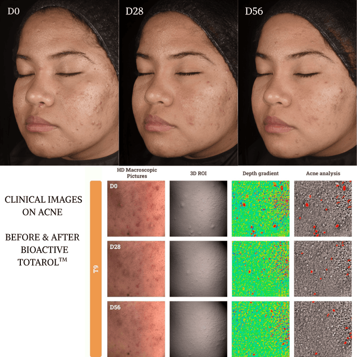 skincare clinical study bioactive totarol TWYG