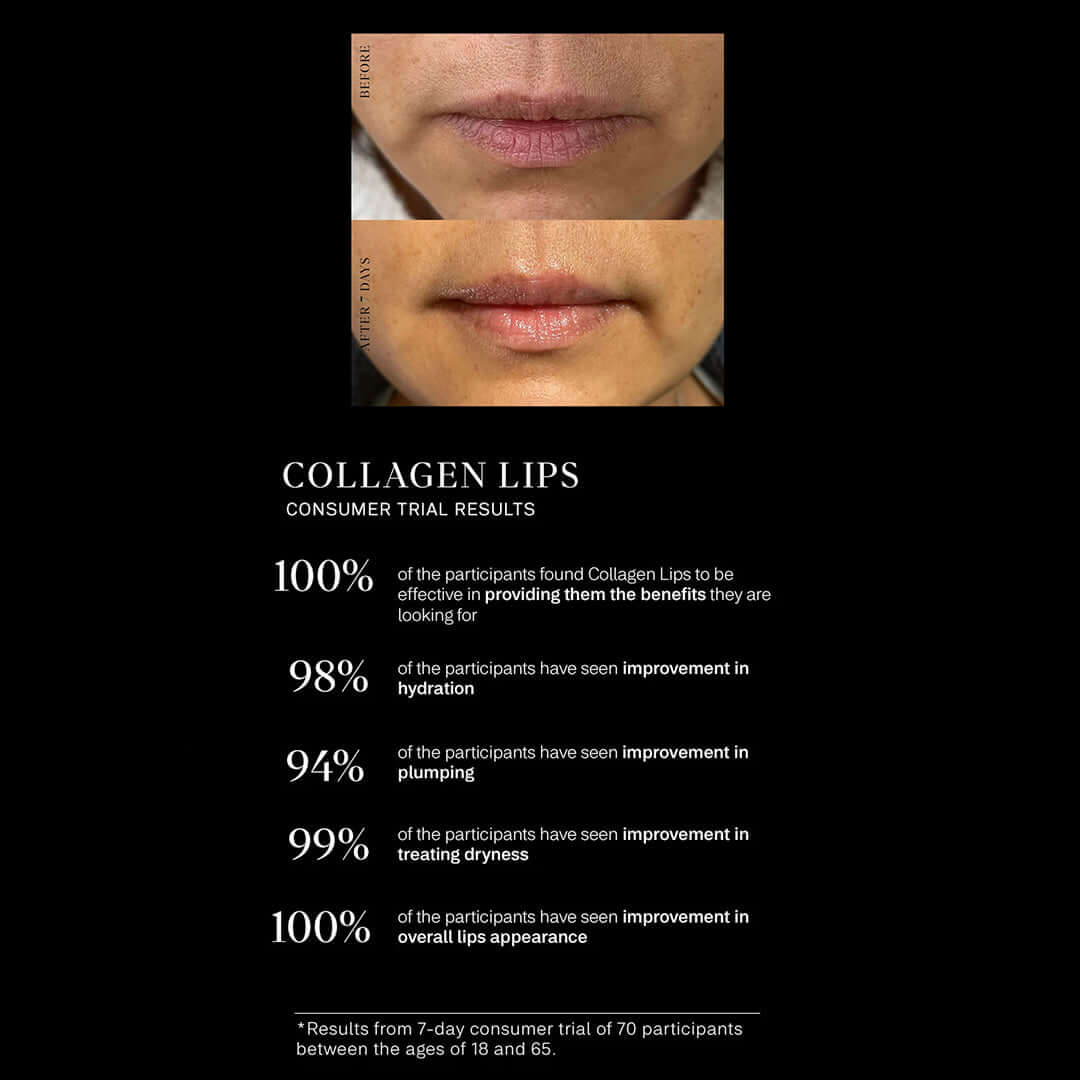 IMBIBE collagen lips before and after 