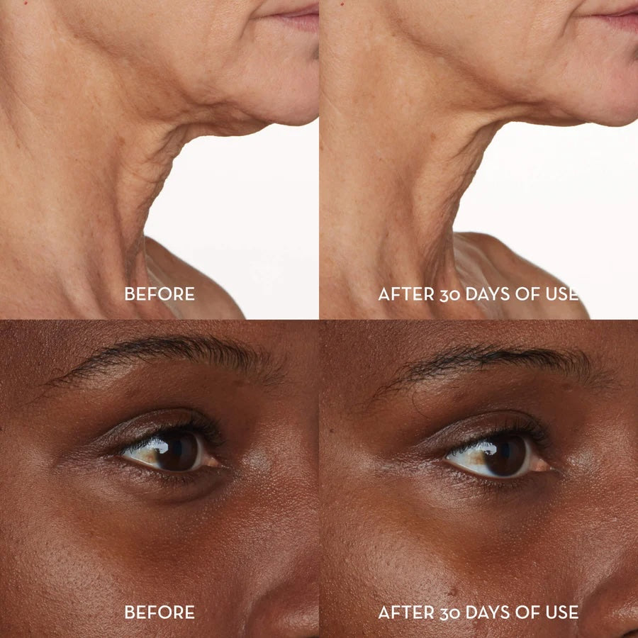 furtuna skin skincare results reviews