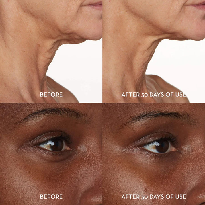 furtuna skin skincare results reviews