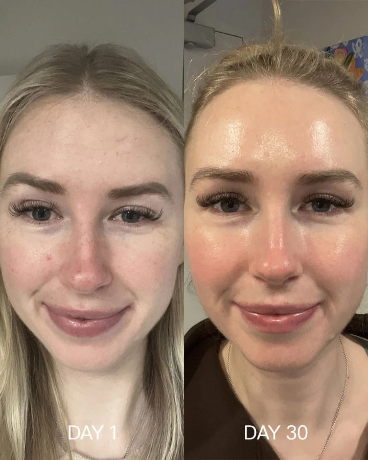 Super skin health made in Australia
