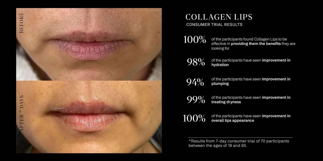 Imbibe collagen lips trial results plumping hydration