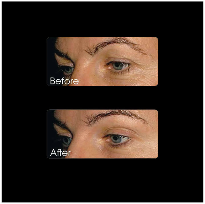 mirical collagen before after results